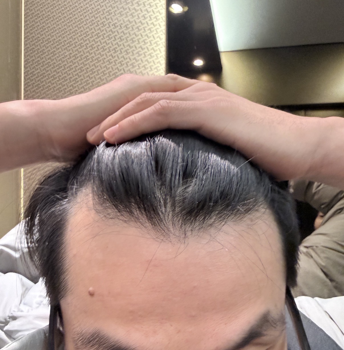 수술전